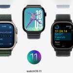 Apple watch 11 Series